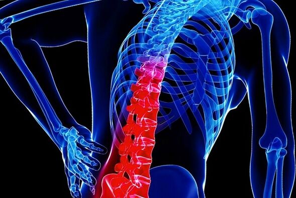 The reasons for the development of thoracic osteochondosis