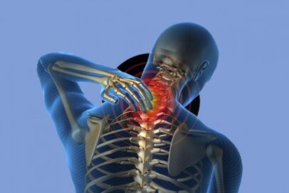 Pain in the neck with osteochondrosis