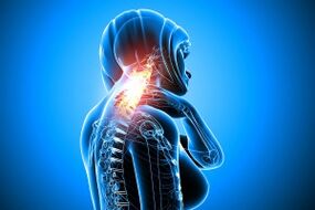 osteochondrosis in the cervical column